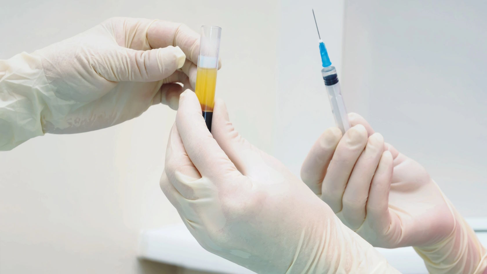 Osocze bogatopłytkowe, co to jest?