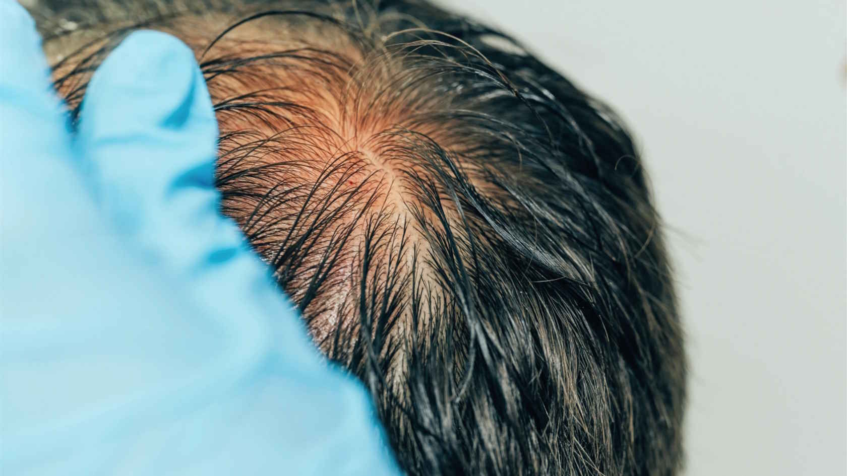 Ile kosztuje wizyta w gabinecie trychologicznym?