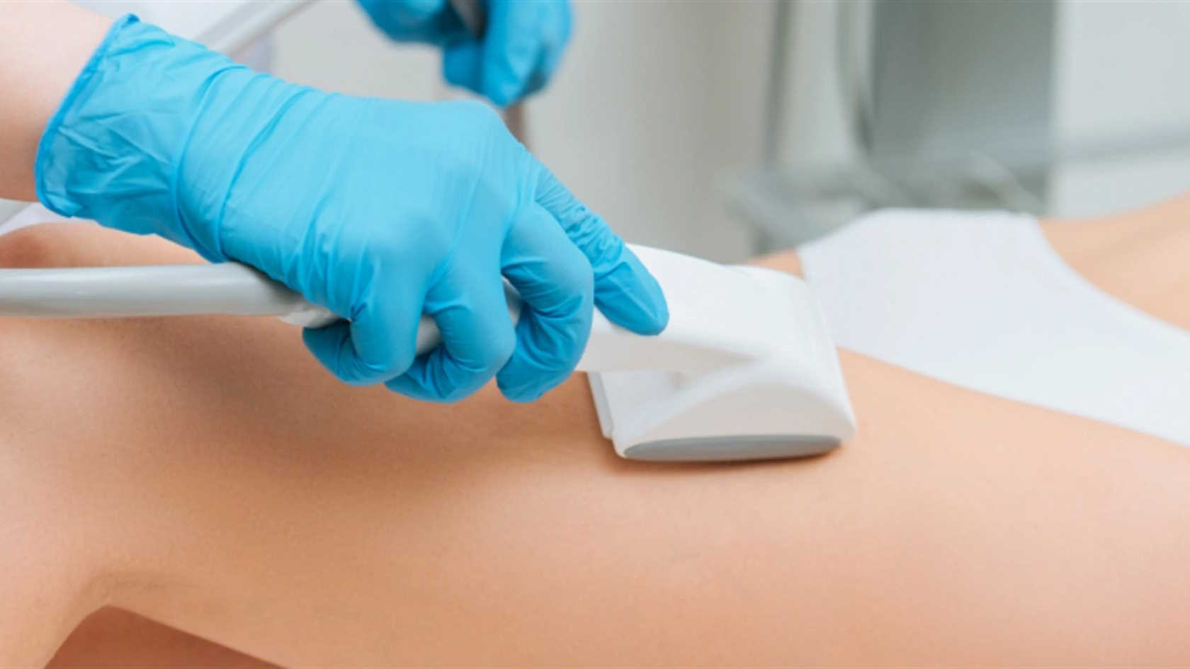 Hydroksyapatyt wapnia - efekty zabiegu przed i po zastosowaniu