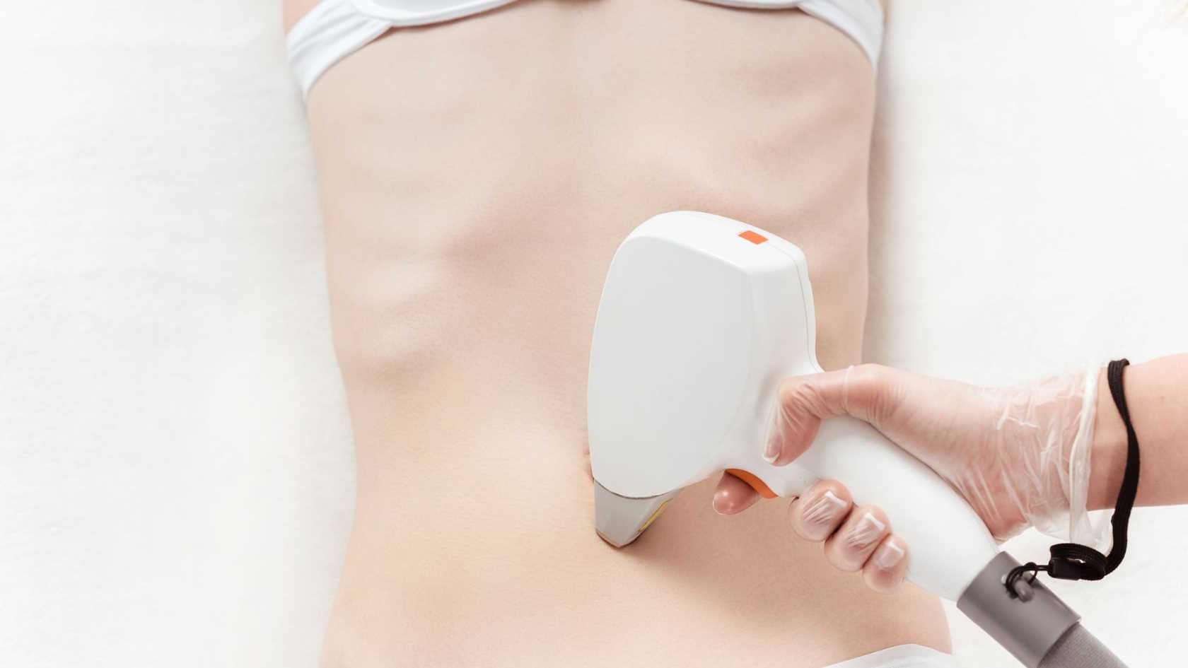 Kriolipoliza - na czym polega zabieg i jakie daje efekty?