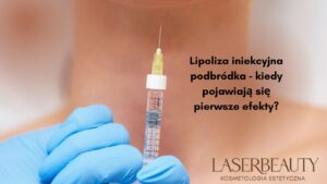 Lipoliza iniekcyjna podbródka - kiedy pojawiają się pierwsze efekty?